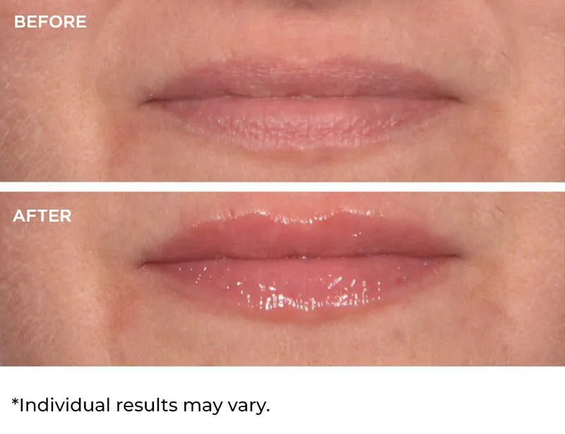 Hydro-Screen Lip Plumper - Vanilla