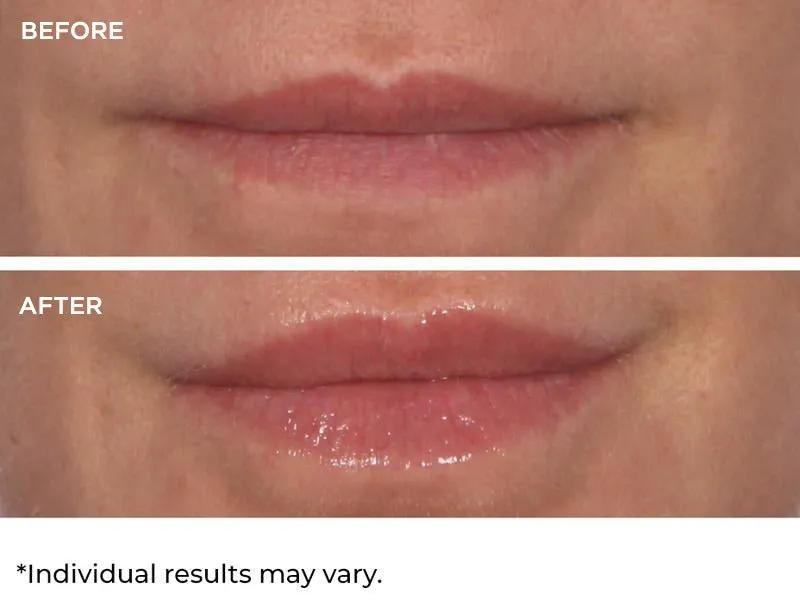 Hydro-Screen Lip Plumper - Vanilla